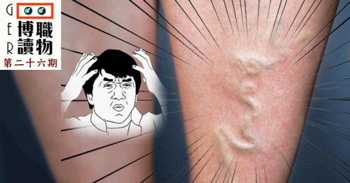 小腿長出青蛇！中醫教你應對方法
